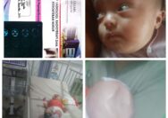 Donasi Untuk Rukaya,Bayi menderita Hydrocephalus " Rp 10.000 atau berikan kami Doa"