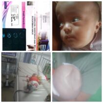 Donasi Untuk Rukaya,Bayi menderita Hydrocephalus " Rp 10.000 atau berikan kami Doa"