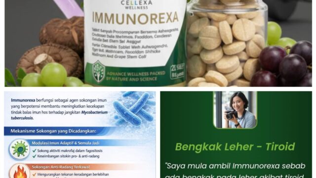 Immunorexa Produk Herbal Terbaik, Sangat Bagus Untuk Imun Tubuh, Inilah Kandungan Nya